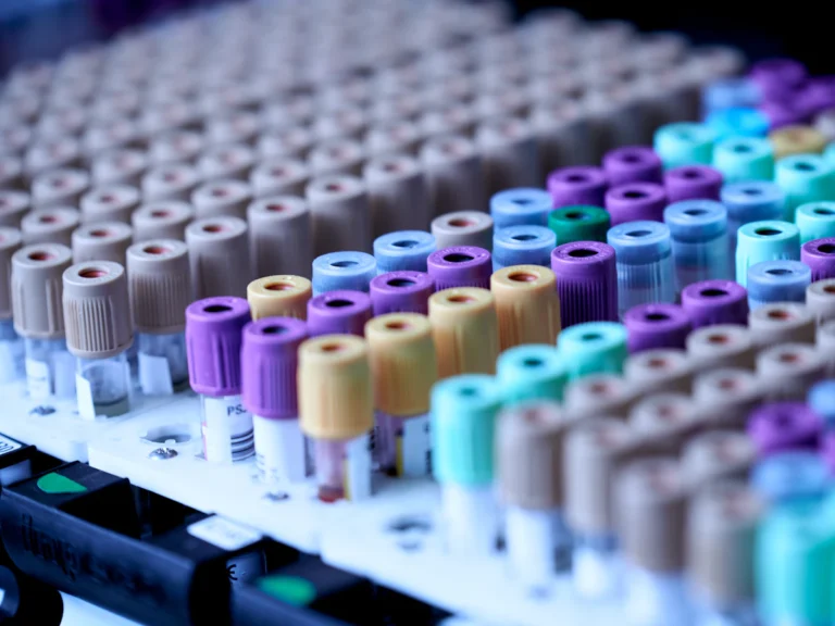 Rows of medical blood collection tubes with colorful caps in a laboratory rack