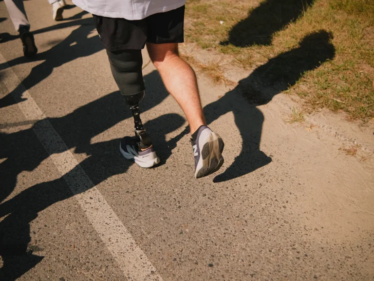 Runner with prosthetic leg racing on asphalt path